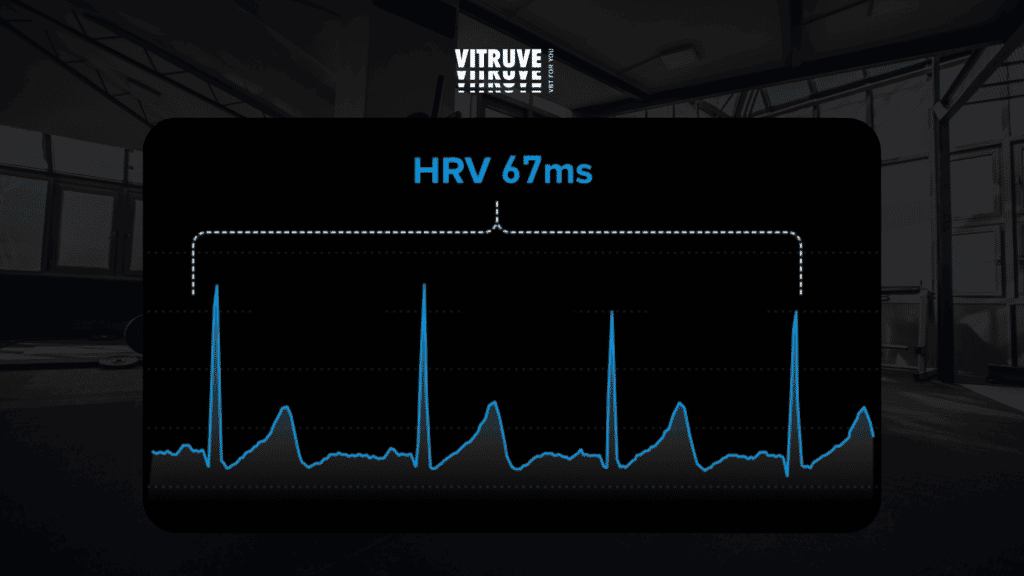 heart rate variability