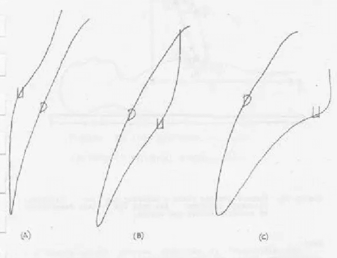 La biomecánica y el punto de estancamiento