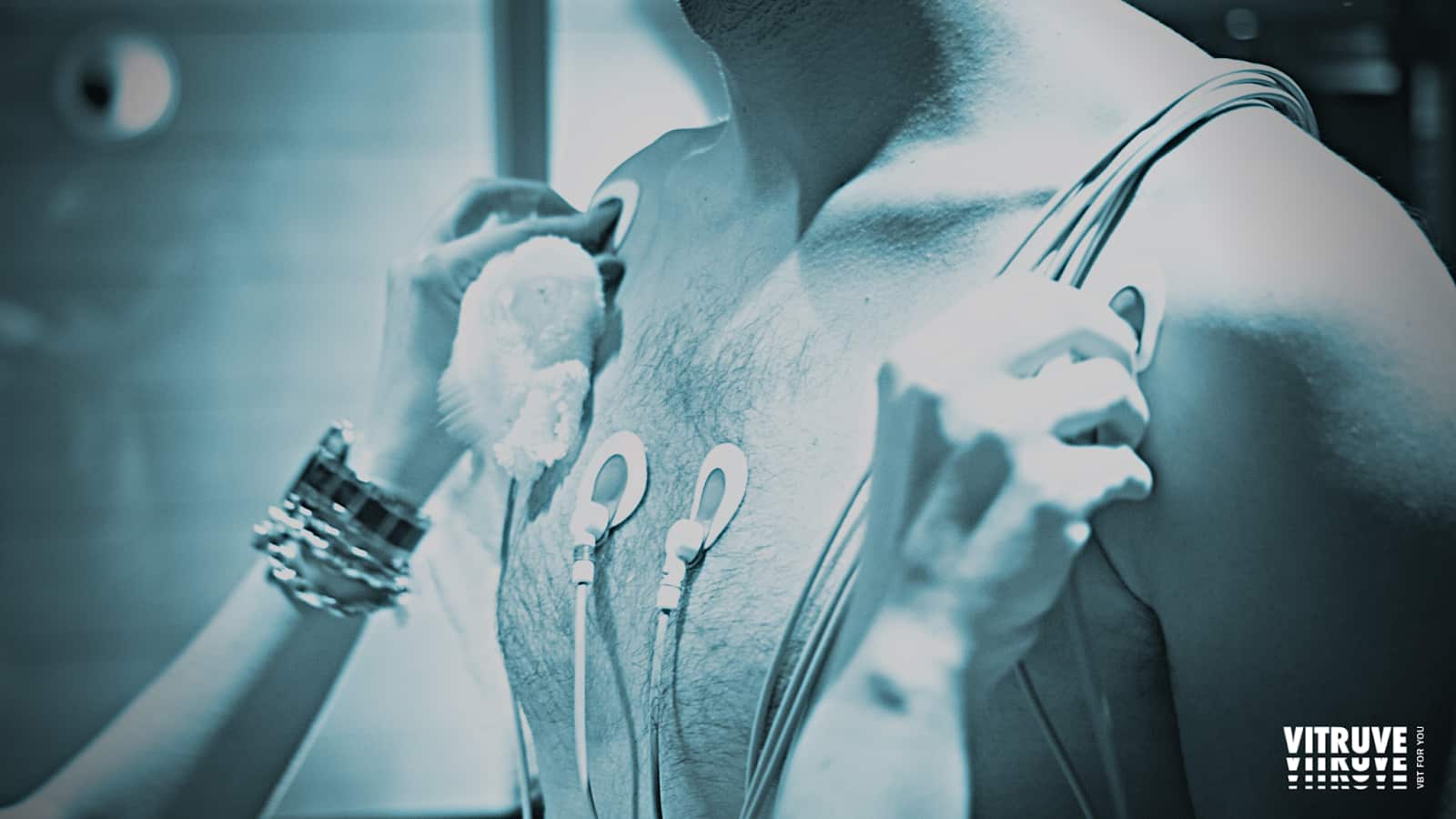 Variabilité de la fréquence cardiaque (HRV) comme indicateur pour l&rsquo;analyse sportive